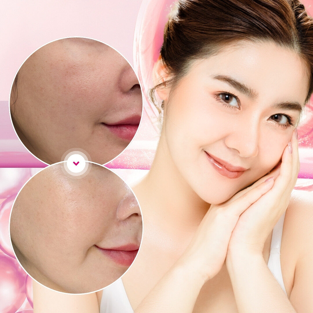 Kết quả tự nhiên