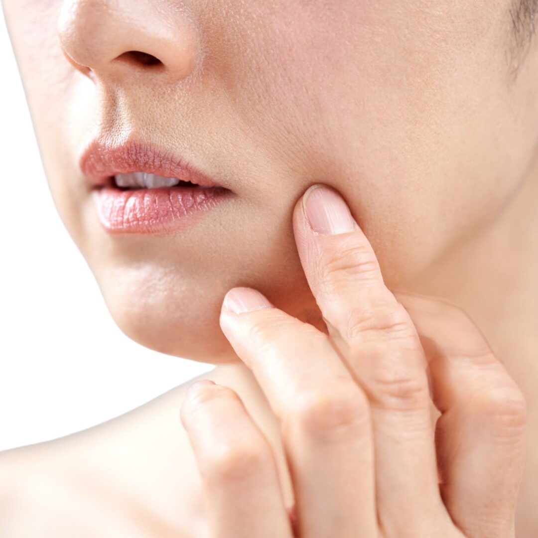 Khuôn mặt chảy xệ chùn nhão