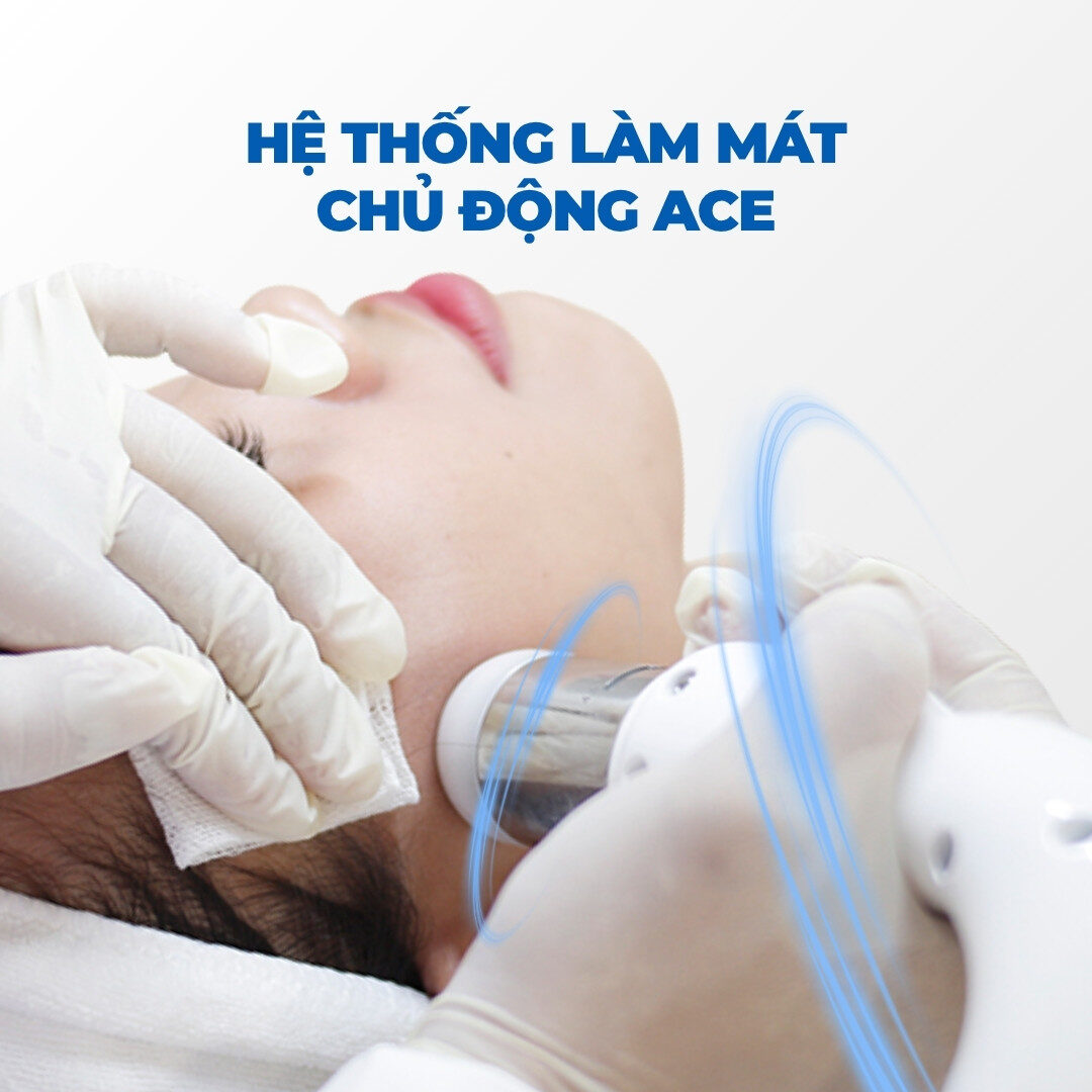 Làm mát chủ độgn ACE