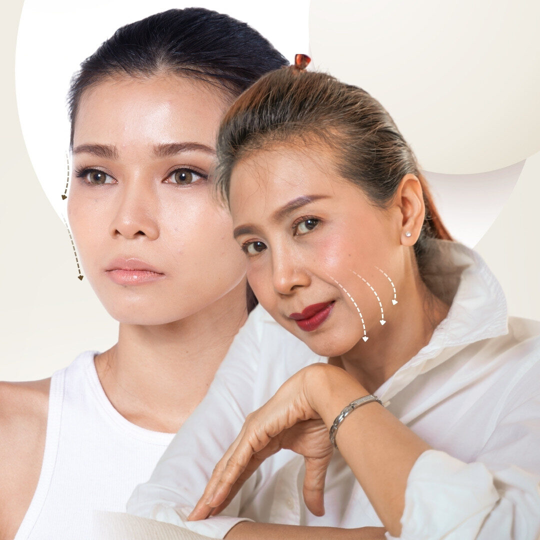 Mặt hóp - lão hóa