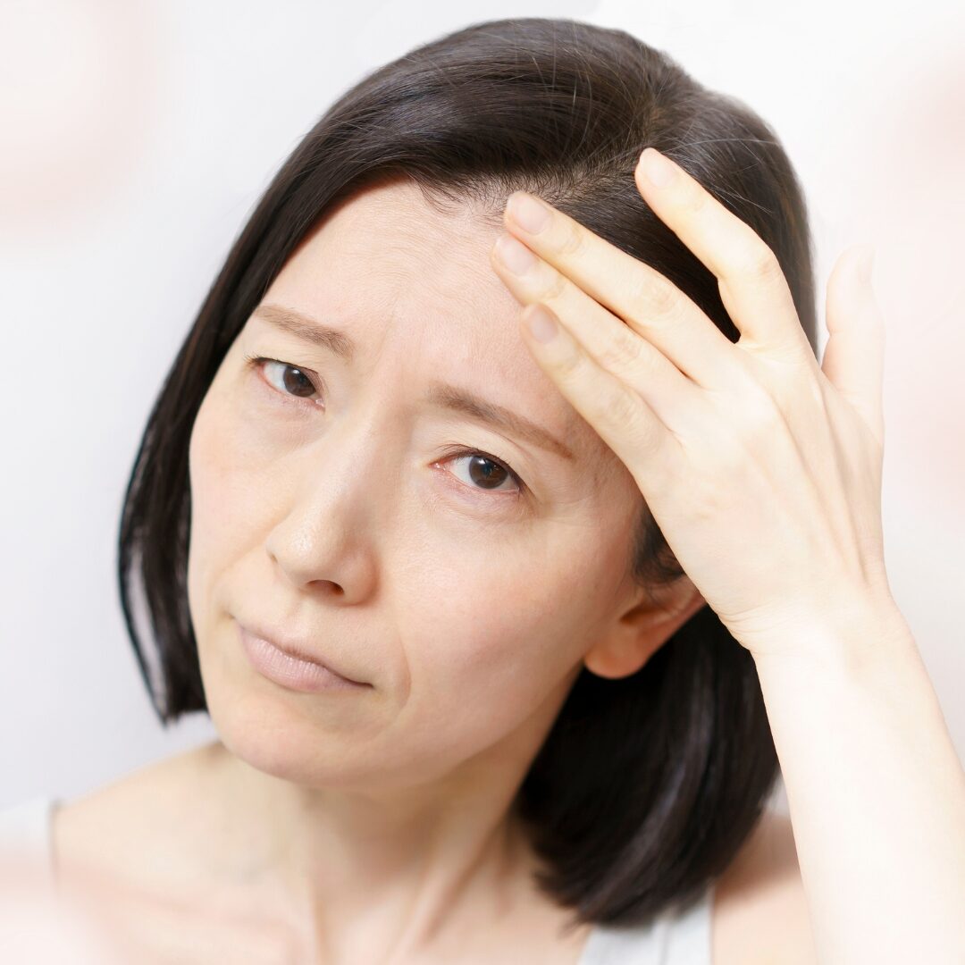 Nếp nhăn động