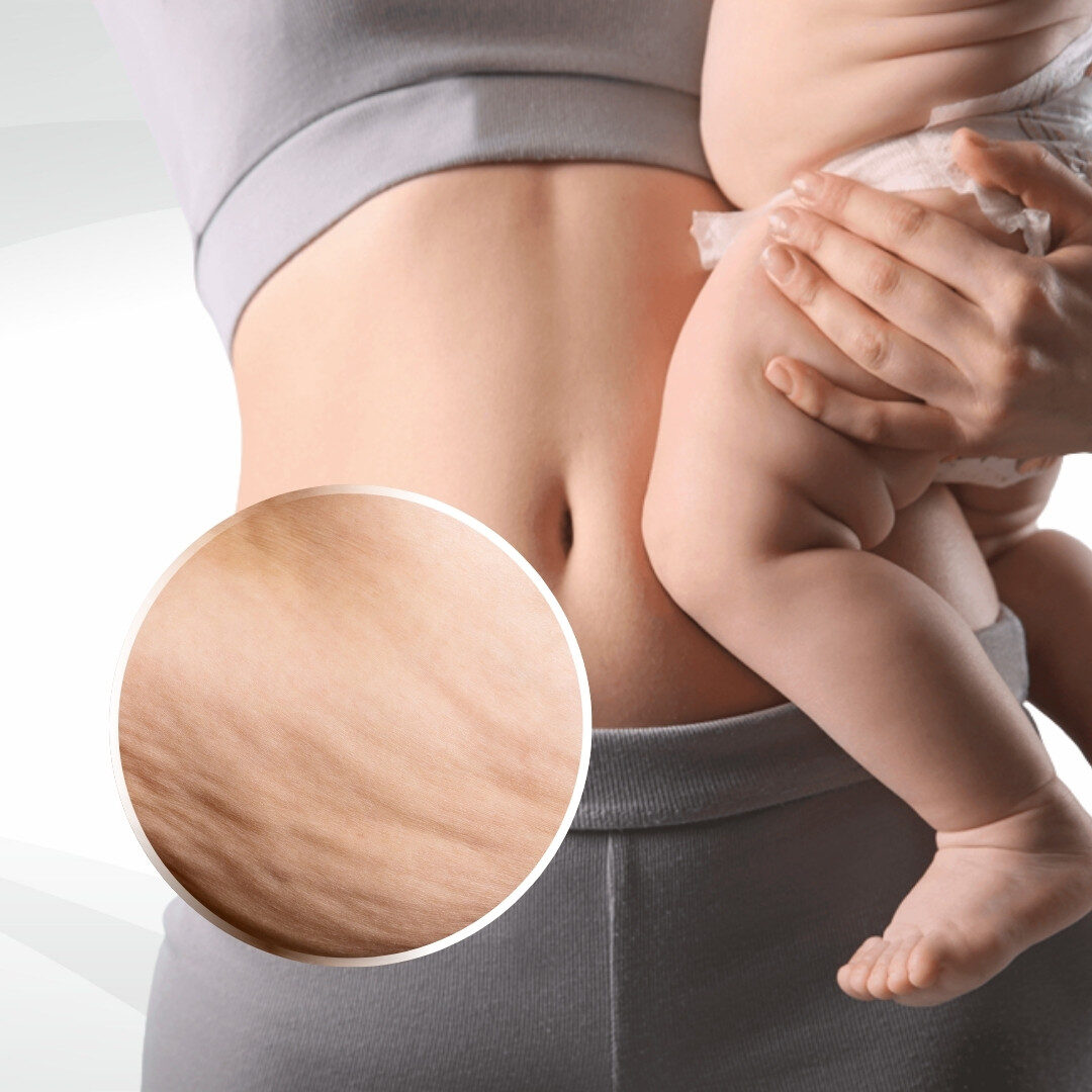 Phụ nữ sau sinh Phụ nữ sau sinh