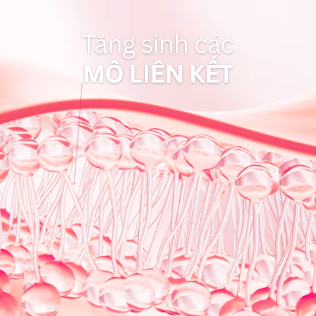Tăng sinh mô liên kết
