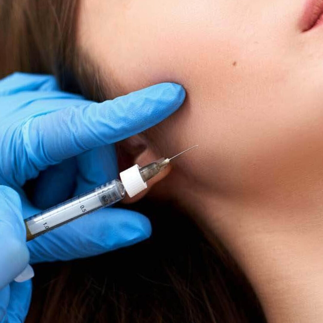 Tiêm botox cơ cắn hàm Tiêm botox cơ cắn hàm