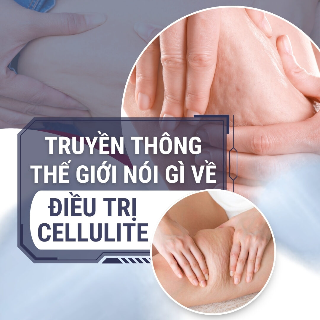 Truyền thông thế giới nói gì về điều trị cellulite Truyền thông thế giới nói gì về điều trị cellulite