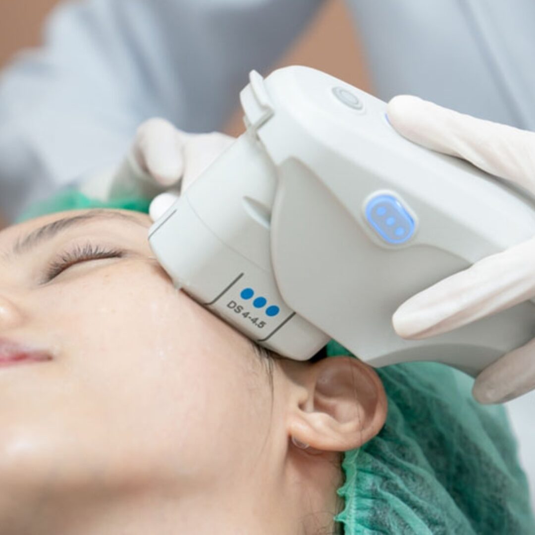 Ultherapy Prime