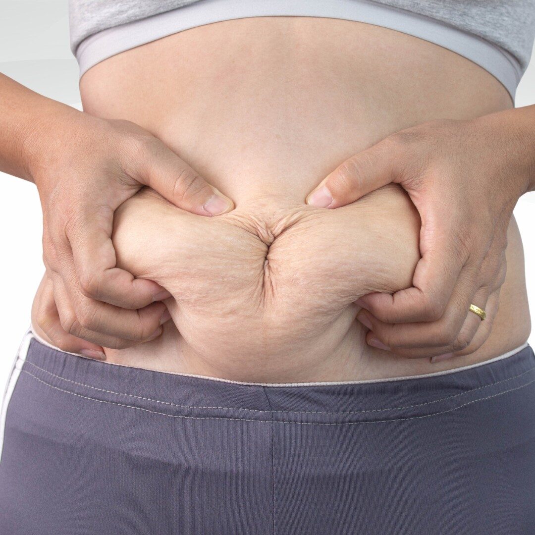 Vùng bụng Vùng bụng